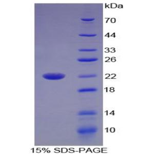 白介素17B(IL17B)重组蛋白