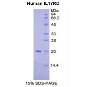 白介素17受体D(IL17RD)重组蛋白,Recombinant Interleukin 17 Receptor D (IL17RD)