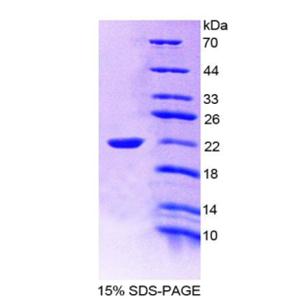 白介素19(IL19)重組蛋白,Recombinant Interleukin 19 (IL19)