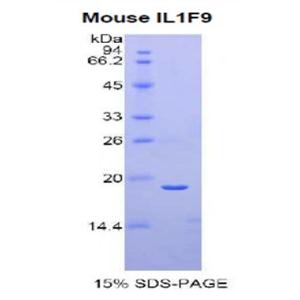 白介素1家族成员9(IL1F9)重组蛋白