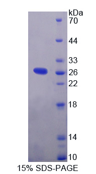 白介素1受体辅助蛋白样蛋白2(IL1RAPL2)重组蛋白,Recombinant Interleukin 1 Receptor Accessory Protein Like Protein 2 (IL1RAPL2)