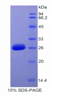 白介素1受體關(guān)聯(lián)激酶3(IRAK3)重組蛋白,Recombinant Interleukin 1 Receptor Associated Kinase 3 (IRAK3)