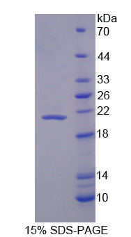 白介素1受体拮抗剂(IL1RA)重组蛋白,Recombinant Interleukin 1 Receptor Antagonist (IL1RA)