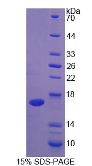 白介素2(IL2)重组蛋白,Recombinant Interleukin 2 (IL2)