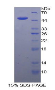 白介素21(IL21)重组蛋白,Recombinant Interleukin 21 (IL21)