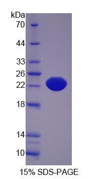 白介素21受体(IL21R)重组蛋白,Recombinant Interleukin 21 Receptor (IL21R)