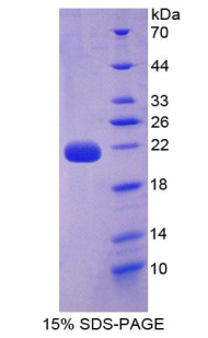 白介素22(IL22)重組蛋白,Recombinant Interleukin 22 (IL22)