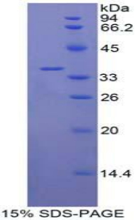 白介素22受體(IL22R)重組蛋白,Recombinant Interleukin 22 Receptor (IL22R)