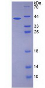 白介素26(IL26)重组蛋白,Recombinant Interleukin 26 (IL26)