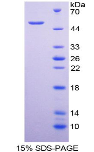 白介素28A(IL28A)重组蛋白,Recombinant Interleukin 28A (IL28A)