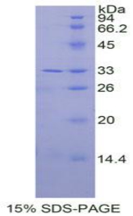 白介素31受体A(IL31RA)重组蛋白,Recombinant Interleukin 31 Receptor A (IL31RA)