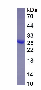 白介素34(IL34)重组蛋白,Recombinant Interleukin 34 (IL34)