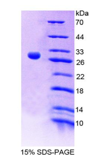 白介素9受體(IL9R)重組蛋白,Recombinant Interleukin 9 Receptor (IL9R)