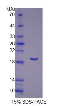 白三烯A4水解酶(LTA4H)重组蛋白,Recombinant Leukotriene A4 Hydrolase (LTA4H)