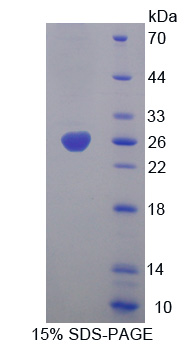 白细胞弹性蛋白酶抑制因子(LEI)重组蛋白,Recombinant Leukocyte Elastase Inhibitor (LEI)