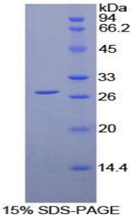 白细胞免疫球蛋白样受体亚家族A成员2(LILRA2)重组蛋白,Recombinant Leukocyte Immunoglobulin Like Receptor Subfamily A, Member 2 (LILRA2)