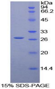 白细胞免疫球蛋白样受体亚家族A成员3(LILRA3)重组蛋白,Recombinant Leukocyte Immunoglobulin Like Receptor Subfamily A, Member 3 (LILRA3)