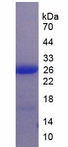 白細(xì)胞免疫球蛋白樣受體亞家族B成員3(LILRB3)重組蛋白,Recombinant Leukocyte Immunoglobulin Like Receptor Subfamily B, Member 3 (LILRB3)