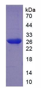 白细胞免疫球蛋白样受体亚家族B成员4(LILRB4)重组蛋白,Recombinant Leukocyte Immunoglobulin Like Receptor Subfamily B, Member 4 (LILRB4)