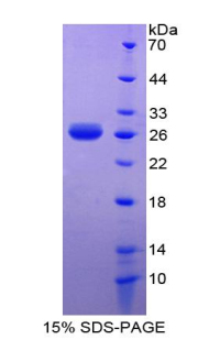 白细胞衍生趋化因子1(LECT1)重组蛋白,Recombinant Leukocyte Cell Derived Chemotaxin 1 (LECT1)