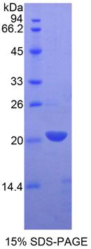 白细胞衍生趋化因子2(LECT2)重组蛋白,Recombinant Leukocyte Cell Derived Chemotaxin 2 (LECT2)