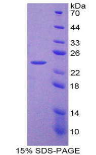 白血病抑制因子(LIF)重組蛋白,Recombinant Leukemia Inhibitory Factor (LIF)