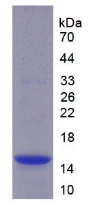 半胱氨酸蛋白酶抑制剂4(CST4)重组蛋白,Recombinant Cystatin 4 (CST4)