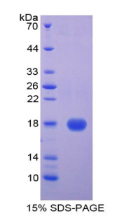 半胱氨酸蛋白酶抑制剂5(CST5)重组蛋白,Recombinant Cystatin 5 (CST5)