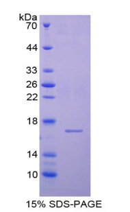 半胱氨酸蛋白酶抑制剂6(CST6)重组蛋白,Recombinant Cystatin 6 (CST6)