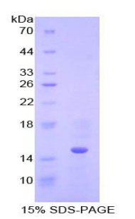 半胱氨酸蛋白酶抑制劑B(CSTB)重組蛋白,Recombinant Cystatin B (CSTB)