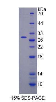 半胱氨酸豐富分泌蛋白3(CRISP3)重組蛋白,Recombinant Cysteine Rich Secretory Protein 3 (CRISP3)