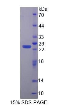 半胱氨酸甘氨酸丰富蛋白1(CSRP1)重组蛋白,Recombinant Cysteine And Glycine Rich Protein 1 (CSRP1)