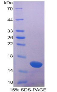 半乳糖凝集素1(GAL1)重组蛋白,Recombinant Galectin 1 (GAL1)