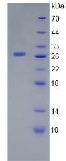 半乳糖凝集素12(GAL12)重組蛋白,Recombinant Galectin 12 (GAL12)