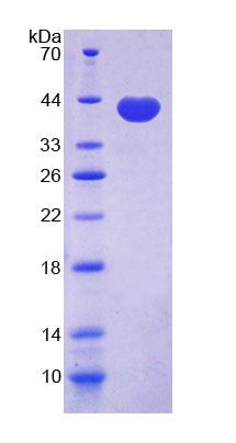 半乳糖凝集素4(GAL4)重组蛋白,Recombinant Galectin 4 (GAL4)