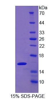 半乳糖凝集素9C(GAL9C)重组蛋白,Recombinant Galectin 9C (GAL9C)