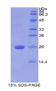 半乳糖神经酰胺酶(GALC)重组蛋白,Recombinant Galactosylceramidase (GALC)