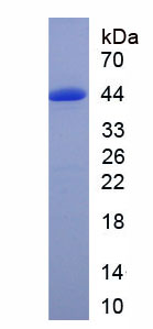 半椎蛋白1(HMCN1)重組蛋白,Recombinant Hemicentin 1 (HMCN1)