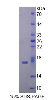 胞苷脫氨酶(CDA)重組蛋白,Recombinant Cytidine Deaminase (CDA)