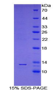 胞浆多聚A结合蛋白1样蛋白(PABPC1L)重组蛋白,Recombinant Poly A Binding Protein Cytoplasmic 1 Like Protein (PABPC1L)