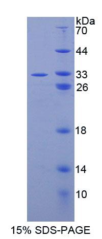 胞浆多聚元件结合蛋白1(CPEB1)重组蛋白,Recombinant Cytoplasmic Polyadenylation Element Binding Protein 1 (CPEB1)