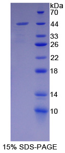 胞浆抗蛋白水解酶3(CAP3)重组蛋白,Recombinant Cytoplasmic Antiproteinase 3 (CAP3)