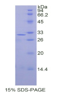 胞裂蛋白5(SEPT5)重组蛋白,Recombinant Septin 5 (SEPT5)