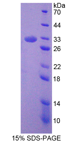 胞裂蛋白6(SEPT6)重组蛋白,Recombinant Septin 6 (SEPT6)