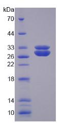 胞外超氧化物歧化酶(SOD3)重組蛋白,Recombinant Superoxide Dismutase 3, Extracellular (SOD3)