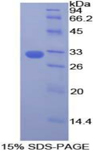 胞质分裂作用因子1(DOCK1)重组蛋白,Recombinant Dedicator Of Cytokinesis 1 (DOCK1)