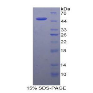 白介素21(IL21)重组蛋白