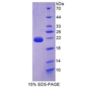 白介素22(IL22)重组蛋白