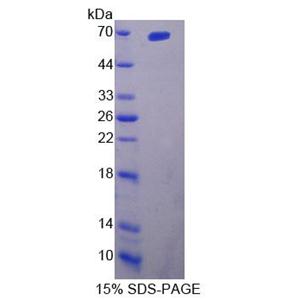 白介素23受体(IL23R)重组蛋白,Recombinant Interleukin 23 Receptor (IL23R)