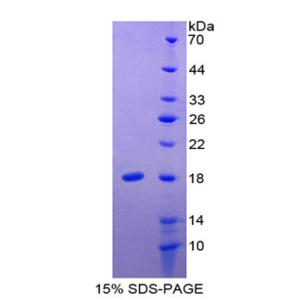 白介素24(IL24)重组蛋白